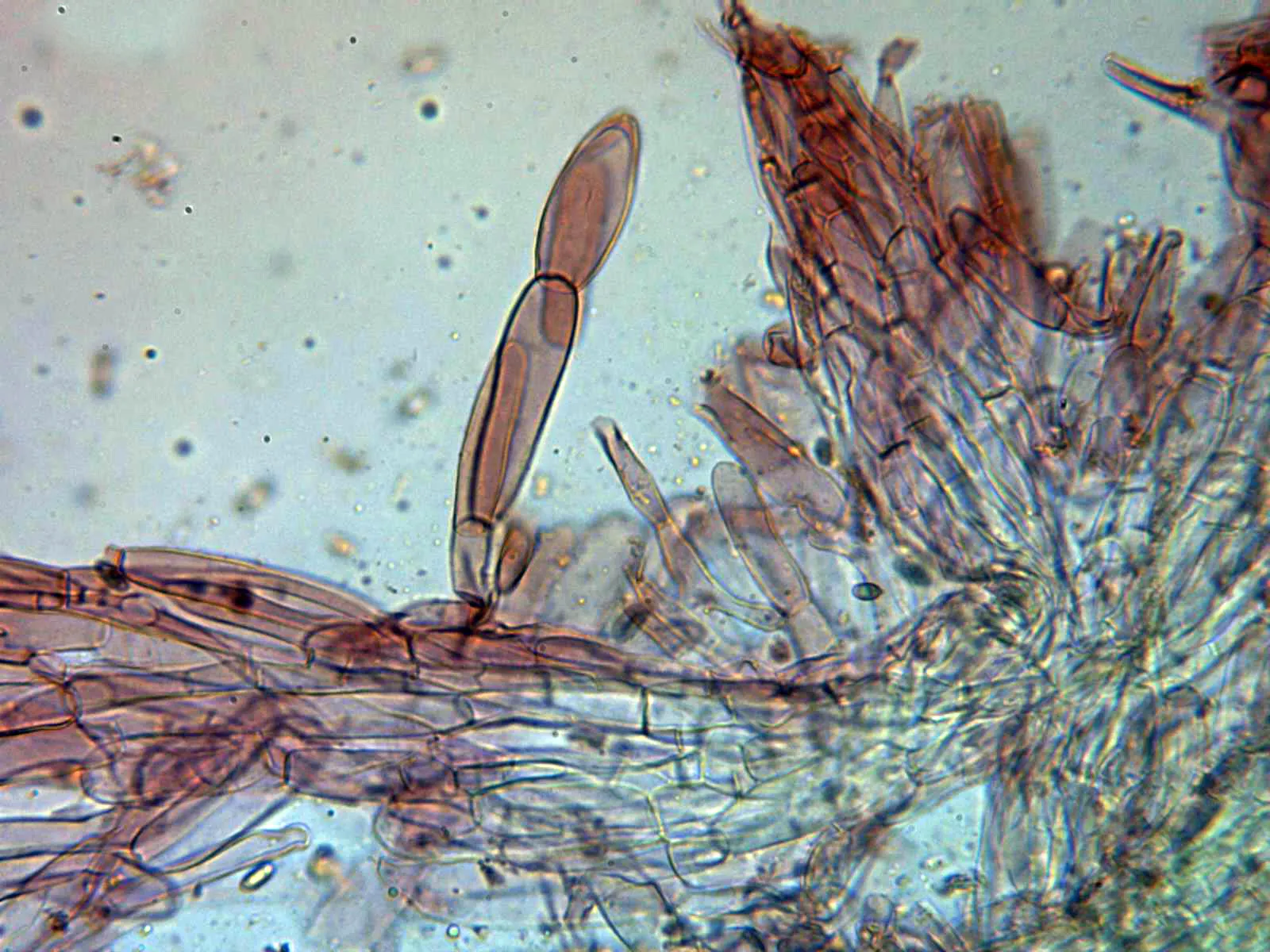 Microscopía de Suillus grevillei - 10 - Caulocistidio alto pié